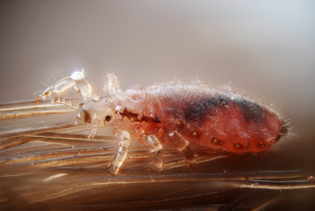 Lice on hair