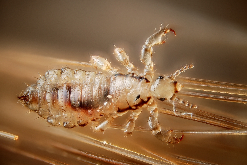 Shocking Facts about Lice