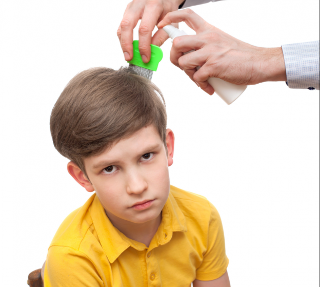 Removing lice from a head